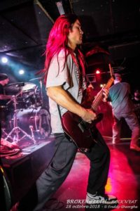 BROKEN TEETH 28 Oct 2018 (1)