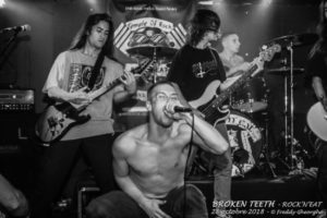 BROKEN TEETH 28 Oct 2018 (16)