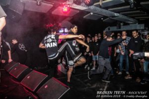 BROKEN TEETH 28 Oct 2018 (2)