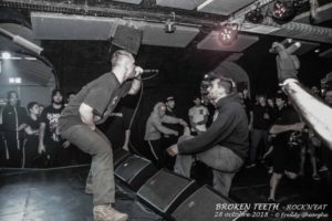 BROKEN TEETH 28 Oct 2018 (4)