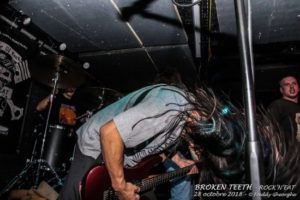 BROKEN TEETH 28 Oct 2018 (7)