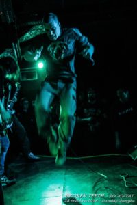 BROKEN TEETH 28 Oct 2018 (8)