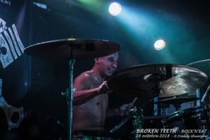 BROKEN TEETH 28 Oct 2018 (9)